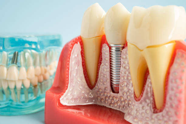 Best General Dentistry  in Prairie View, TX