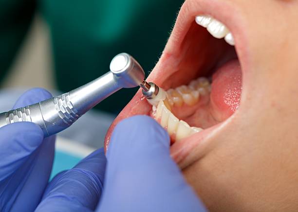 Best Root Canal Treatment  in Prairie View, TX